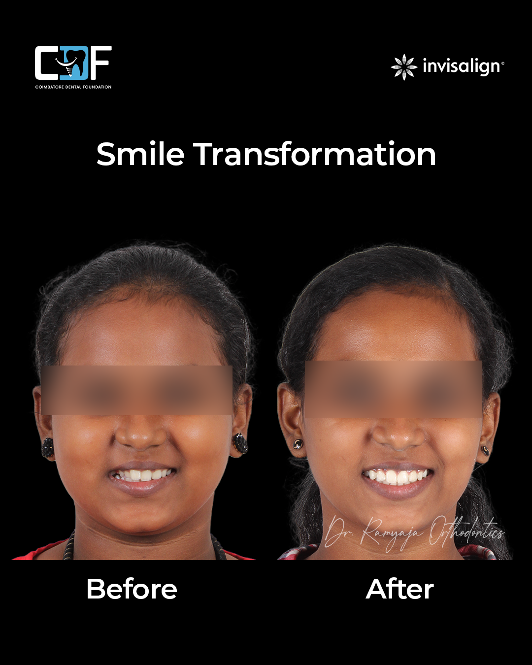 Before After Result